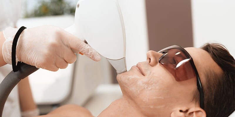 Laser Hair Removal Face